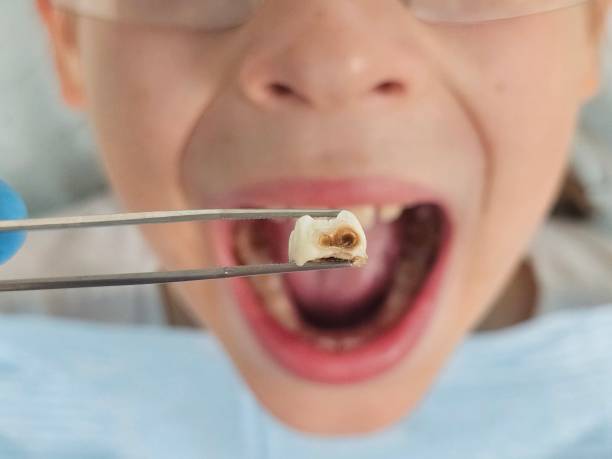 Best Emergency Dentist Near Me  in Burgettstown, PA