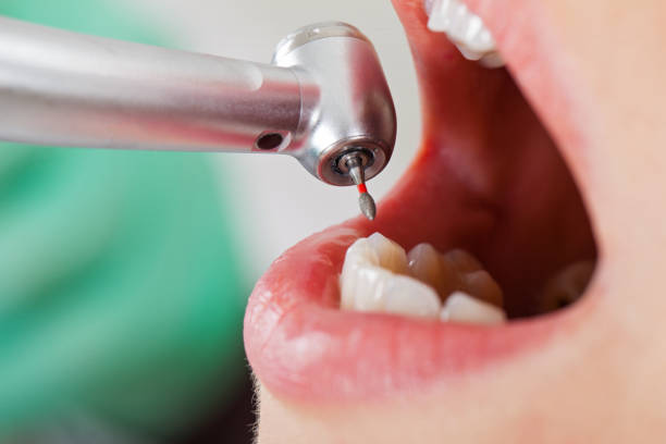 Best Urgent Tooth Repair  in Burgettstown, PA